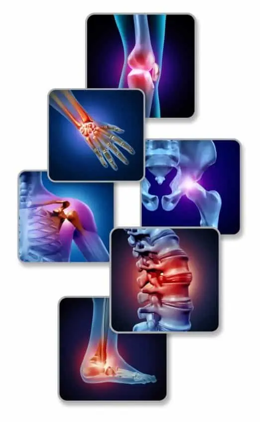 physical therapy picture